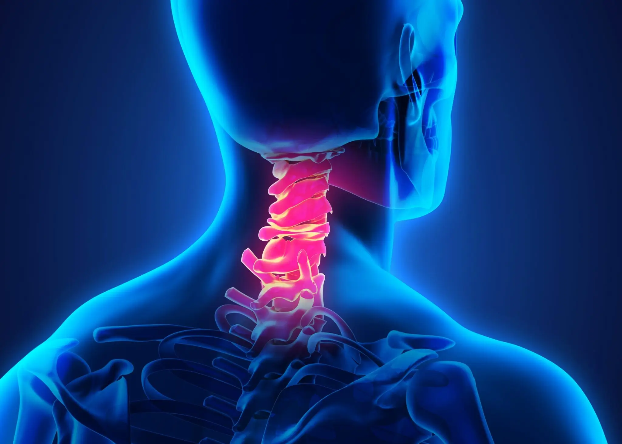 Cervicale